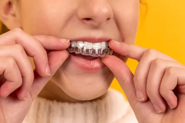 Czy Twoje dziecko potrzebuje pomocy ortodontycznej - na co zwrócić uwagę?